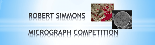 Microscopic view of textured, irregular surfaces and structures.
