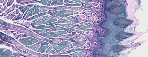 Microscopic view of textured, irregular surfaces and structures.